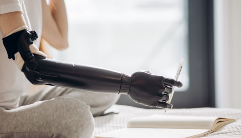 How AI is Redefining Prosthetics: The Future of Human-Machine Connection